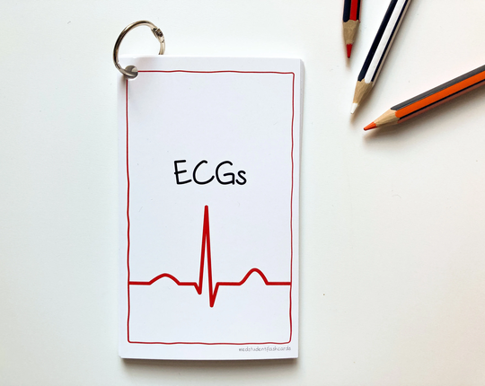 Ecg Rhythms Flashcards