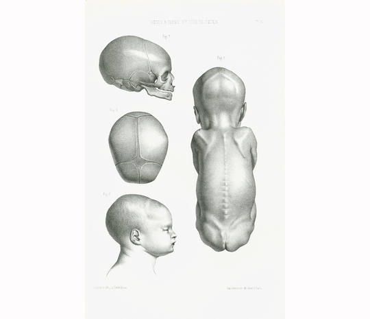 1865 Human Fetus, Antique Obstetrics Print, Anatomy Embryology Gynecology Bourgery Victorian Wall Art 163 Years Old, Medical Chart