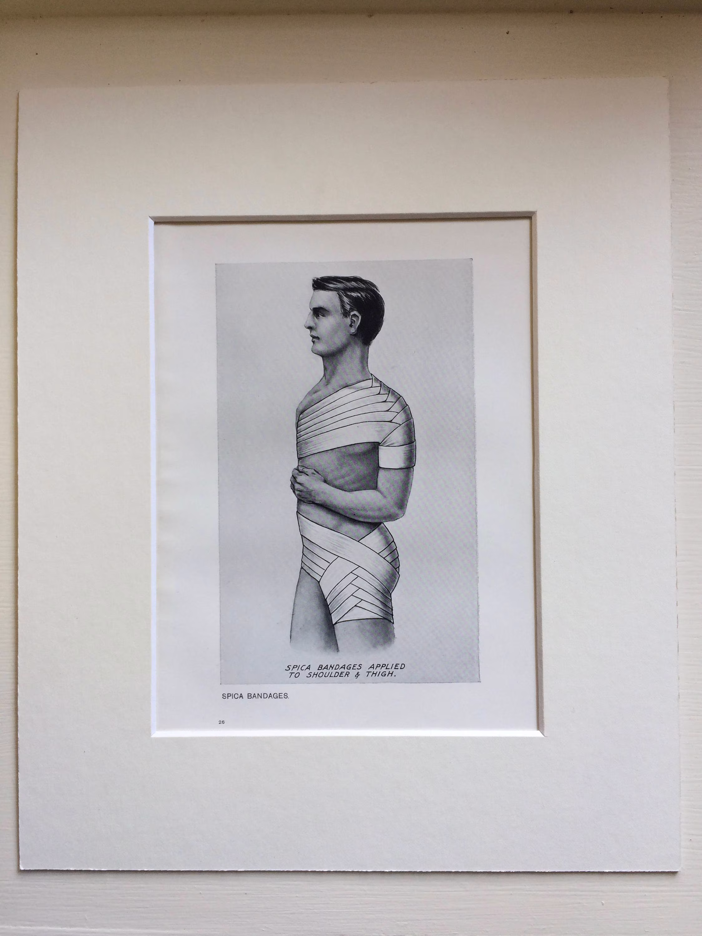 1920S Original Antique Matted Anatomical Print - Bandage Types Spica Bandages Applied To Shoulder & Thigh Anatomy Medicine Doctor